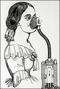 1847 - Első kloroformos altatás